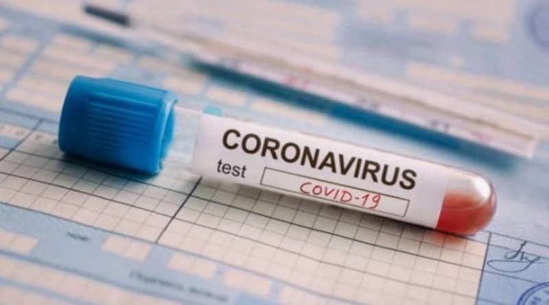 En Salto y la región, casos confirmados de Covid 19 al 27 de julio