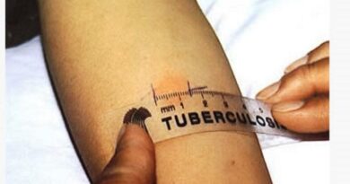 La pandemia provocó un retroceso en la lucha contra la tuberculosis