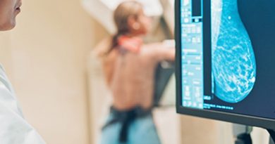 Confirman que la mayoría de las mujeres con cáncer de mama no tiene antecedentes familiares