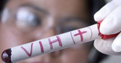 VIH: Más de 140 mil personas viven con la enfermedad